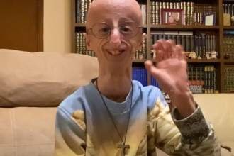 Sammy Basso, héros de la lutte contre la progéria, s&rsquo;éteint à 28 ans