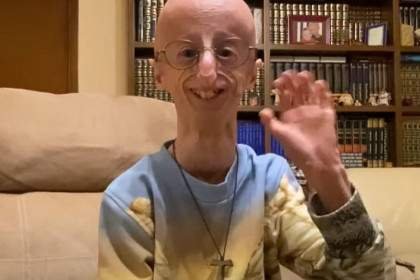 Sammy Basso, héros de la lutte contre la progéria, s&rsquo;éteint à 28 ans