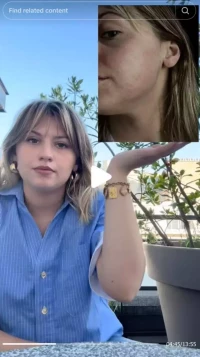 Marine Delplace révèle sa réaction allergique : visage gonflé après test d’huile