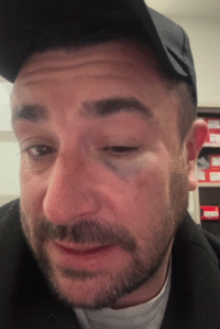 L&rsquo;humoriste Anthony Joubert violemment agressé dans un train avant son spectacle dans l&rsquo;Oise