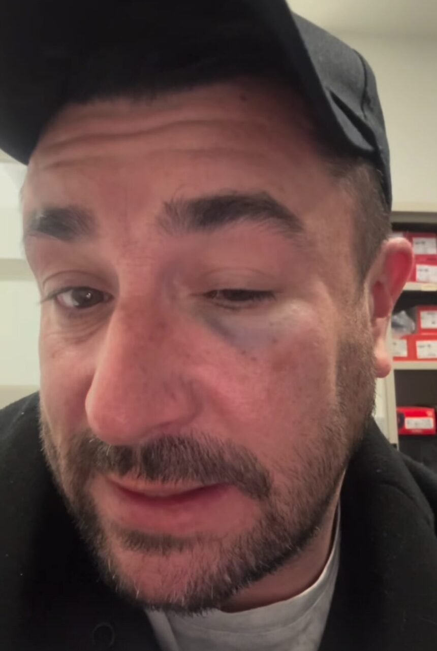L'humoriste anthony joubert violemment agressé dans un train avant son spectacle dans l'oise L’humoriste Anthony Joubert violemment agressé dans un train avant son spectacle dans l’Oise