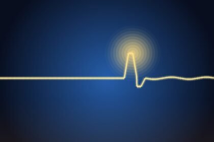 Cardiogramme rétabli après plat — illustration symbolique