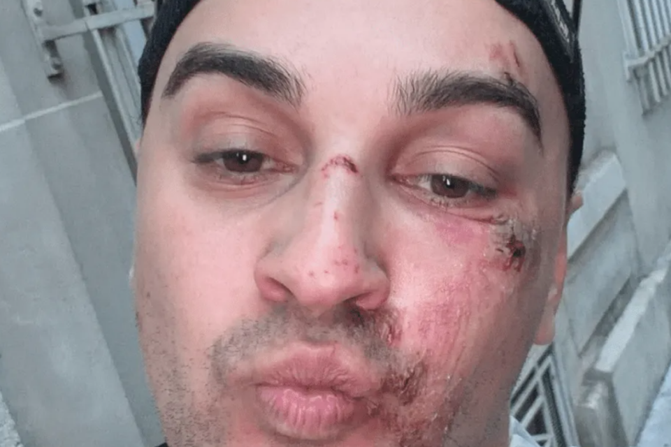Agression homophobe : Kilian Froehly roué de coups à Paris