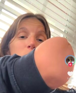 Amputée de la main droite, elle reçoit une amende pour avoir tenu son téléphone dans sa main droite