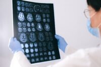 Alzheimer : un acide aminé courant freinerait la maladie Alzheimer : un acide aminé courant freinerait la maladie