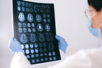 Alzheimer : un acide aminé courant freinerait la maladie