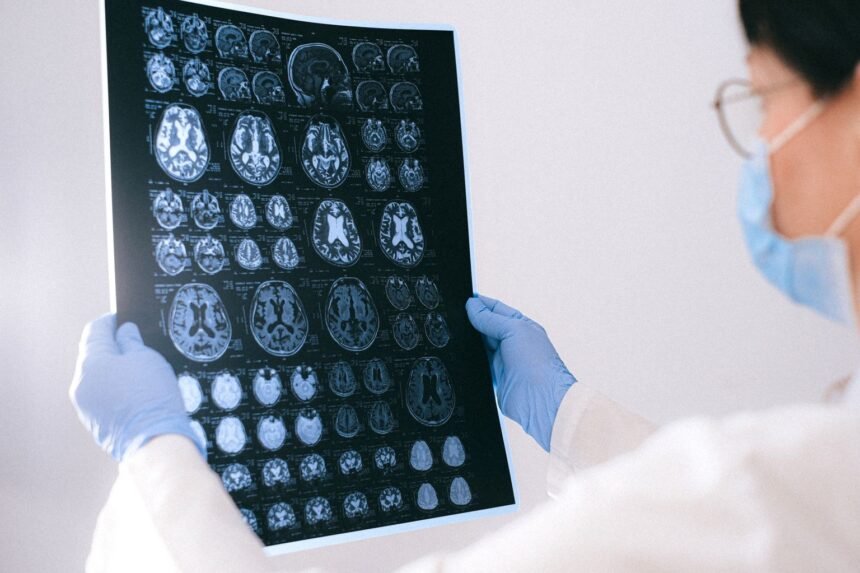 Alzheimer : un acide aminé courant freinerait la maladie Alzheimer : un acide aminé courant freinerait la maladie