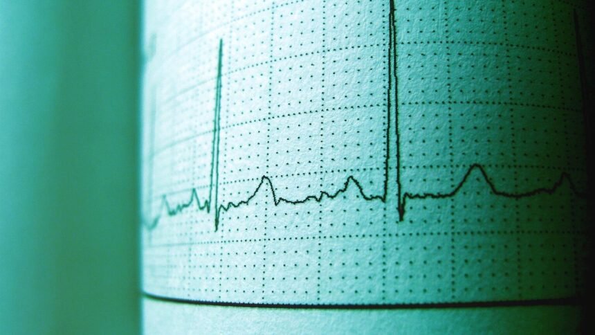 Une ia détecte les maladies cardiaques sur un ecg en 2 secondes Une IA détecte les maladies cardiaques sur un ECG en 2 secondes