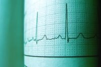 Une ia détecte les maladies cardiaques sur un ecg en 2 secondes Une IA détecte les maladies cardiaques sur un ECG en 2 secondes