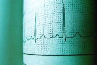 Une IA détecte les maladies cardiaques sur un ECG en 2 secondes