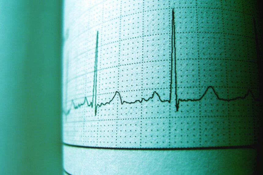 Une ia détecte les maladies cardiaques sur un ecg en 2 secondes Une IA détecte les maladies cardiaques sur un ECG en 2 secondes
